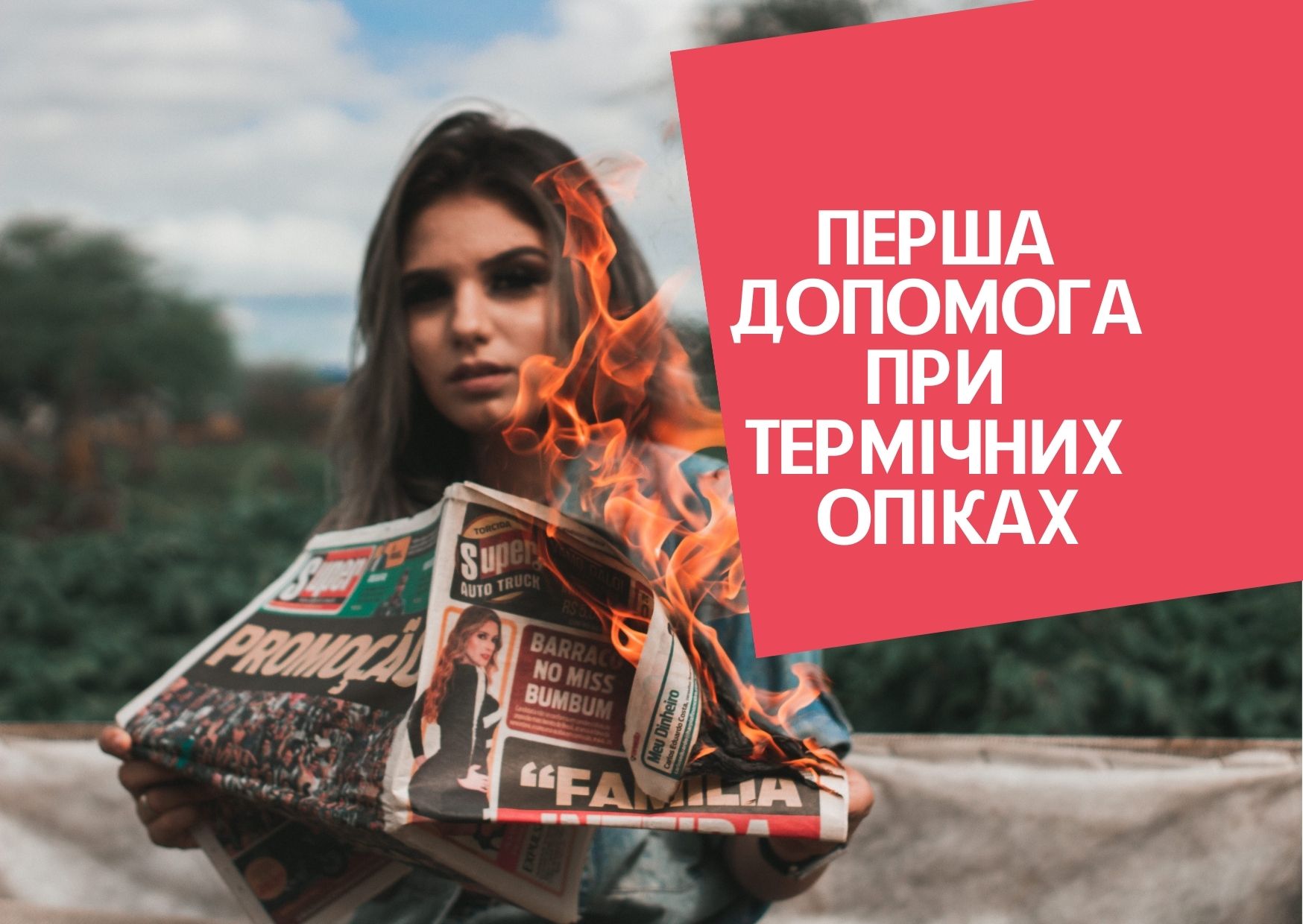 Перша допомога при термічних опіках