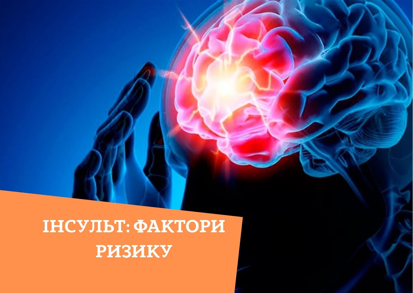 Інсульт: фактори ризику