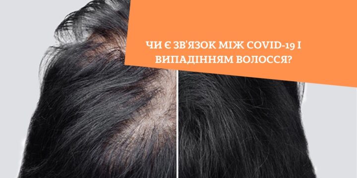 ЧИ МОЖЕ ВИПАДАТИ ВОЛОССЯ ПІСЛЯ КОРОНАВІРУСУ