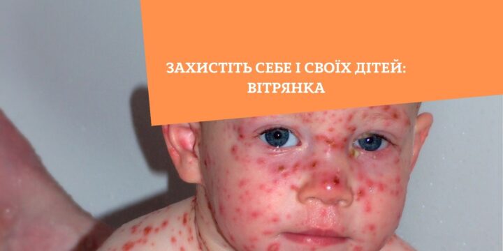 Захистіть себе і своїх дітей: вітрянка