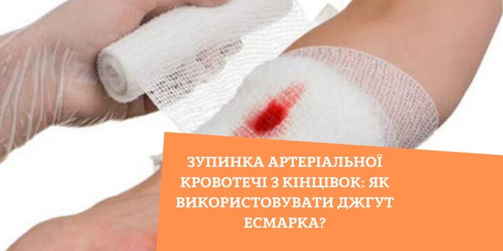 Зупинка артеріальної кровотечі з кінцівок: як використовувати джгут Есмарка?