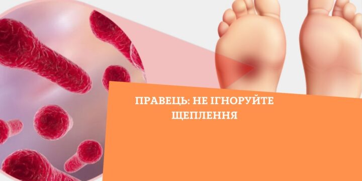 Правець: не ігноруйте щеплення