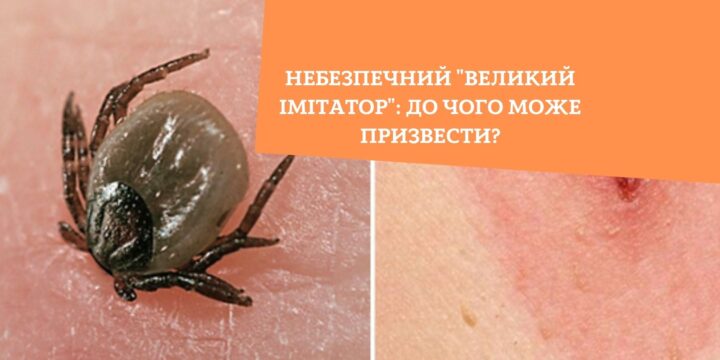 Небезпечний “Великий імітатор”: до чого може призвести?