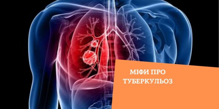 Міфи про туберкульоз