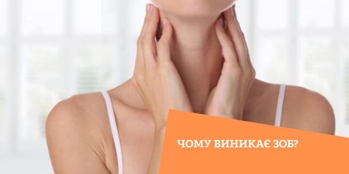 Чому виникає зоб?