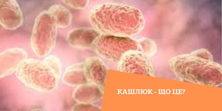 Кашлюк – що це?