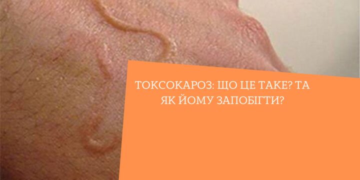 Токсокароз: що це таке? Та як йому запобігти?