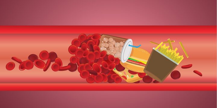 Як контролювати рівень холестерину в організмі