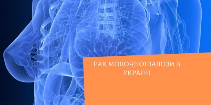 Рак молочної залози в Україні