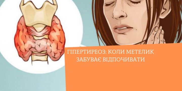 Гіпертиреоз: коли метелик забуває відпочивати