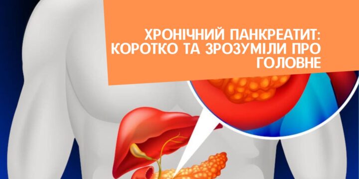 Хронічний панкреатит: коротко та зрозуміли про головне