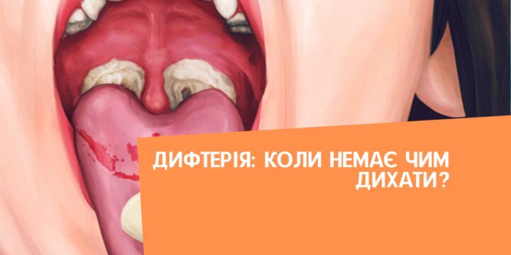 Дифтерія: коли немає чим дихати?