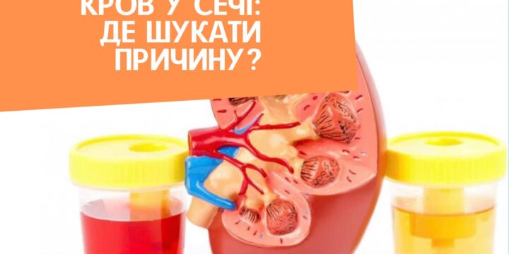 Кров у сечі: де шукати причину?