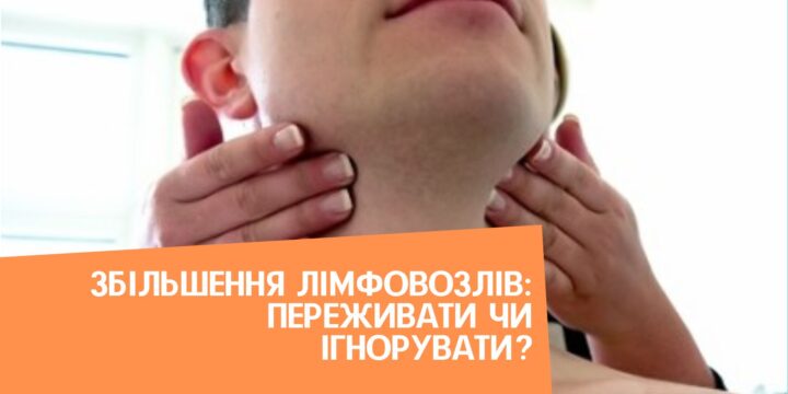 Збільшення лімфовозлів: переживати чи ігнорувати?