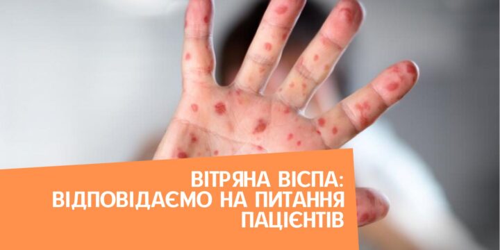 Вітряна віспа: відповідаємо на питання пацієнтів
