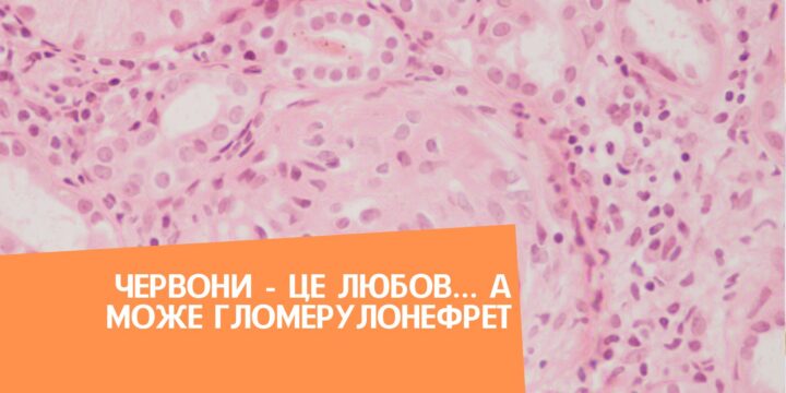 Червони – це любов… А може гломерулонефрет