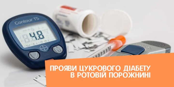 Прояви цукрового діабету в ротовій порожнині