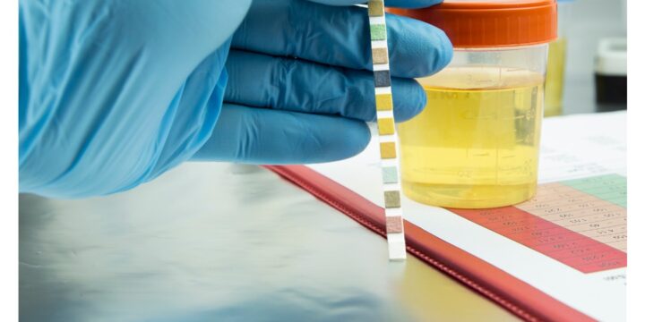 Що означає поява білка в сечі?