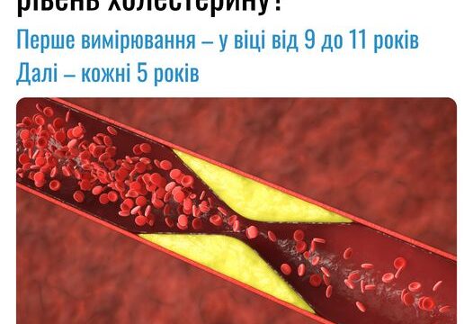 Знімаємо стрес граючись