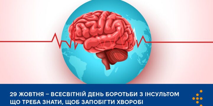 Інсульт: що треба знати, щоб запобігти