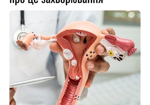 Дисплазія шийки матки: що жінці треба знати про це захворювання